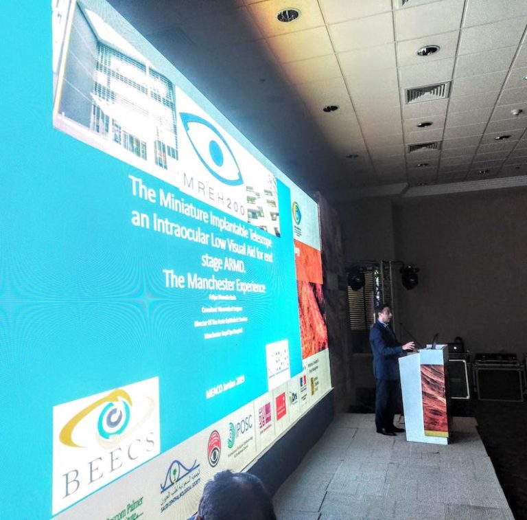 Presentation on Miniature Implantable Telescope for End Stage Macular Degeneration.